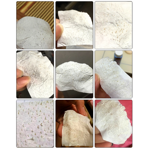 LANBENA - Gesichtsmaske gegen Mitesser