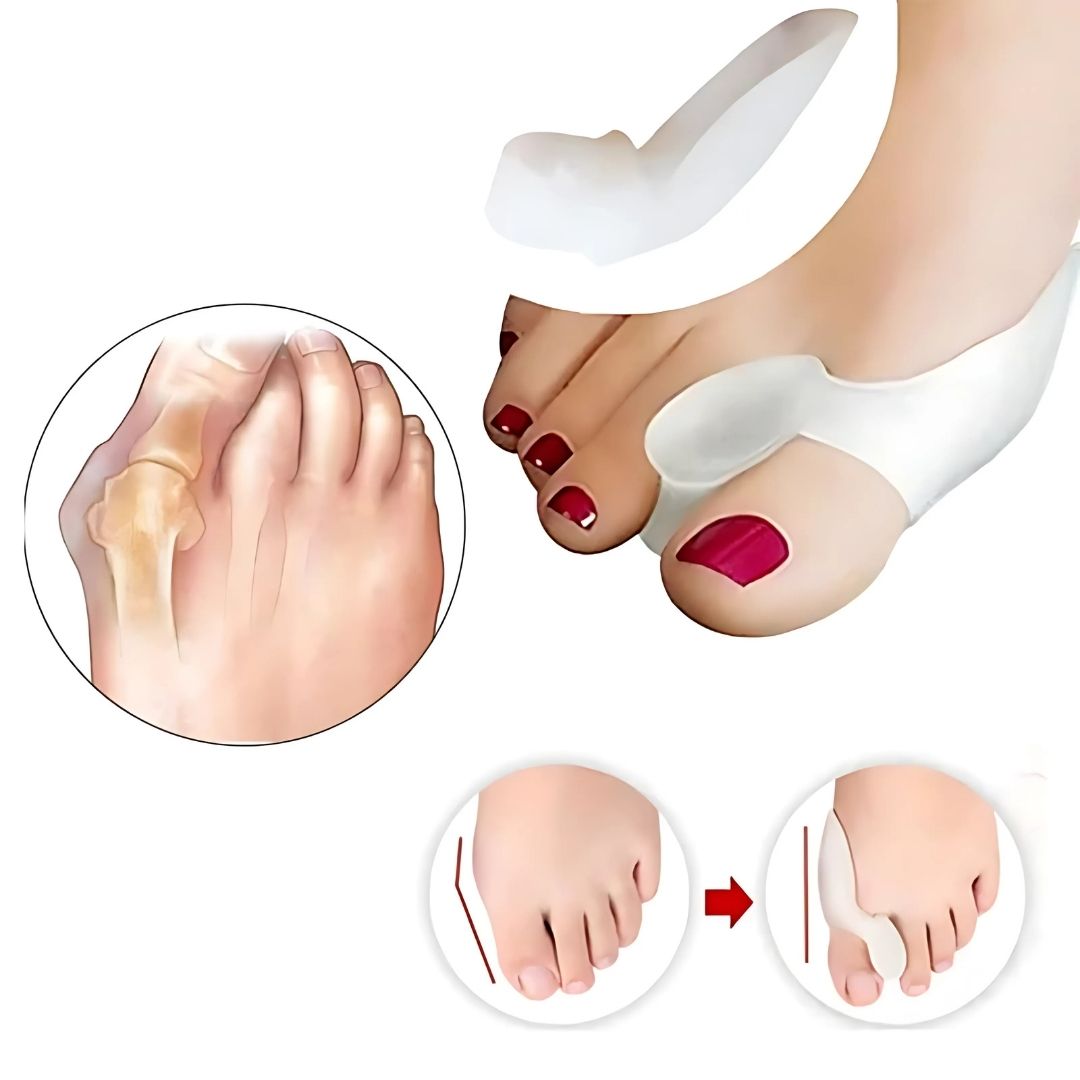 "BunionGuard Silikonschutz für Hallux Valgus, weiches Gel, lindert Schmerzen, korrigiert Zehenstellung, komfortabel"