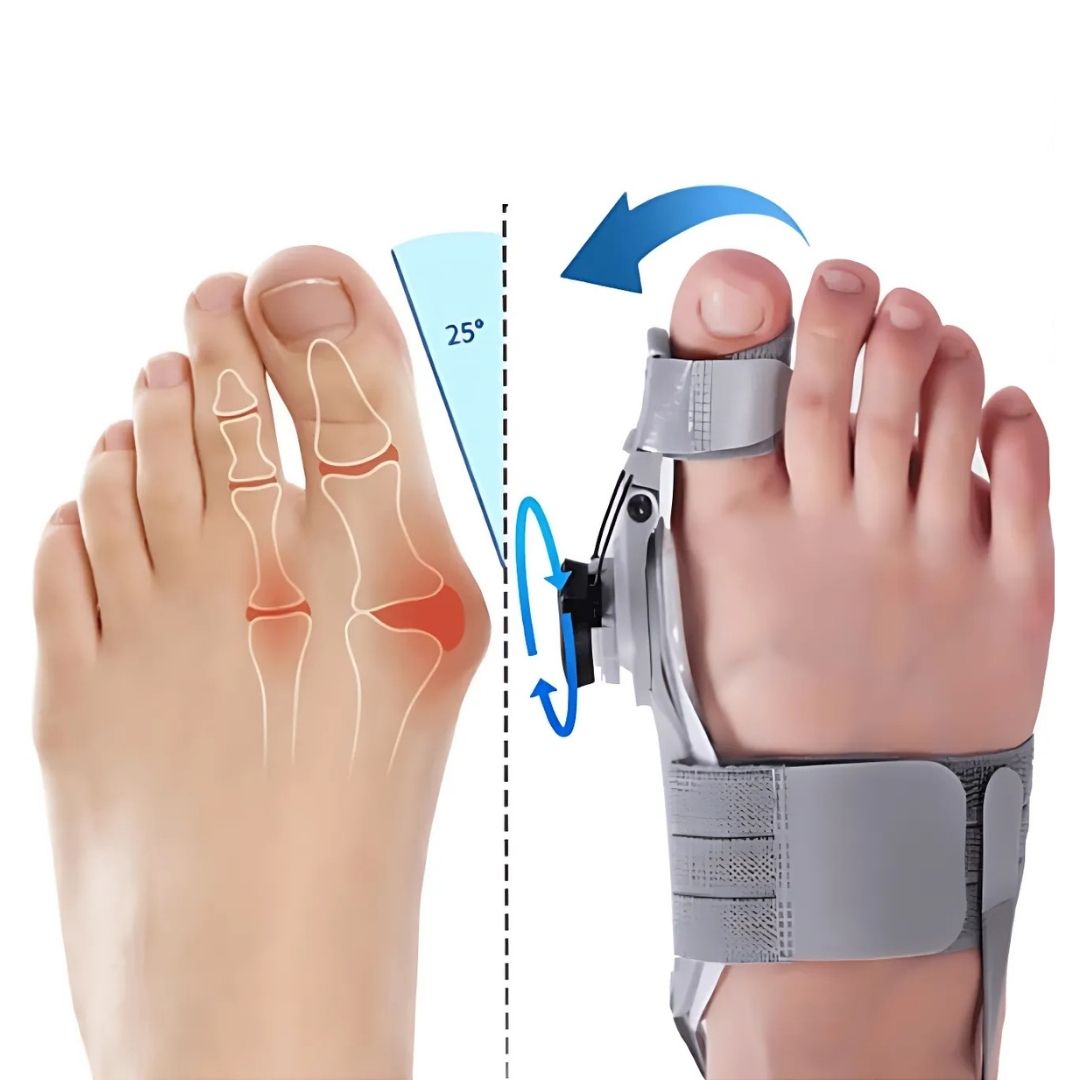 "Einstellbare Hallux Valgus Stütze, sanfte Korrektur und Schmerzlinderung, leichte atmungsaktive Materialien."