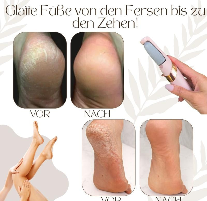 "Elektrischer Hornhautentferner mit ergonomischem Design und LED-Licht, ideal für Pediküre zu Hause, Beauty & Wellness"