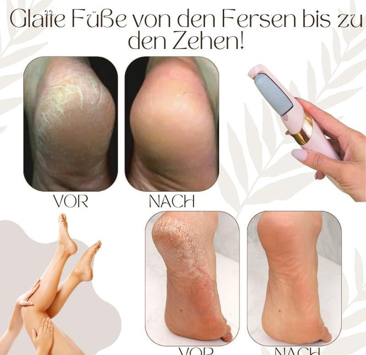 "Elektrischer Hornhautentferner mit ergonomischem Design und LED-Licht, ideal für Pediküre zu Hause, Beauty & Wellness"