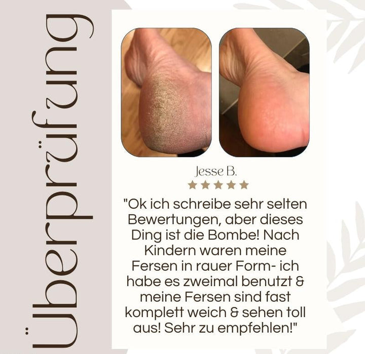 "Elektrischer Hornhautentferner mit ergonomischem Design und LED-Licht, ideal für Pediküre zu Hause, Beauty & Wellness"