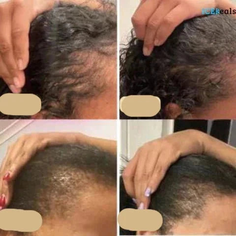 Vorher-Nachher-Bilder Haarwachstum, vegane Haaröl-Anwendung, Verbesserung Haardichte.