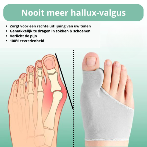 Hautfarbener Hallux Valgus Korrektor für Jugendliche, diskret und atmungsaktiv, bietet schmerzlindernden Komfort im Alltag.